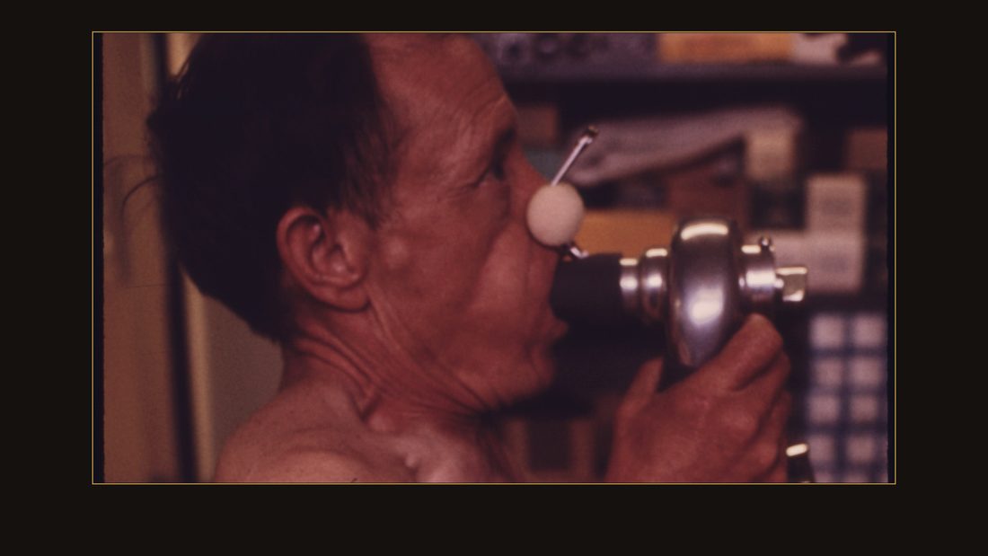 A MINER AT THE BLACK LUNG LABORATORY IN THE APPALACHIAN REGIONAL HOSPITAL IN BECKLEY, WEST VIRGINIA, IS HAVING HIS LUNG CAPACITY TESTED TO DETERMINE WHETHER HE HAS THE DISEASE. BLO