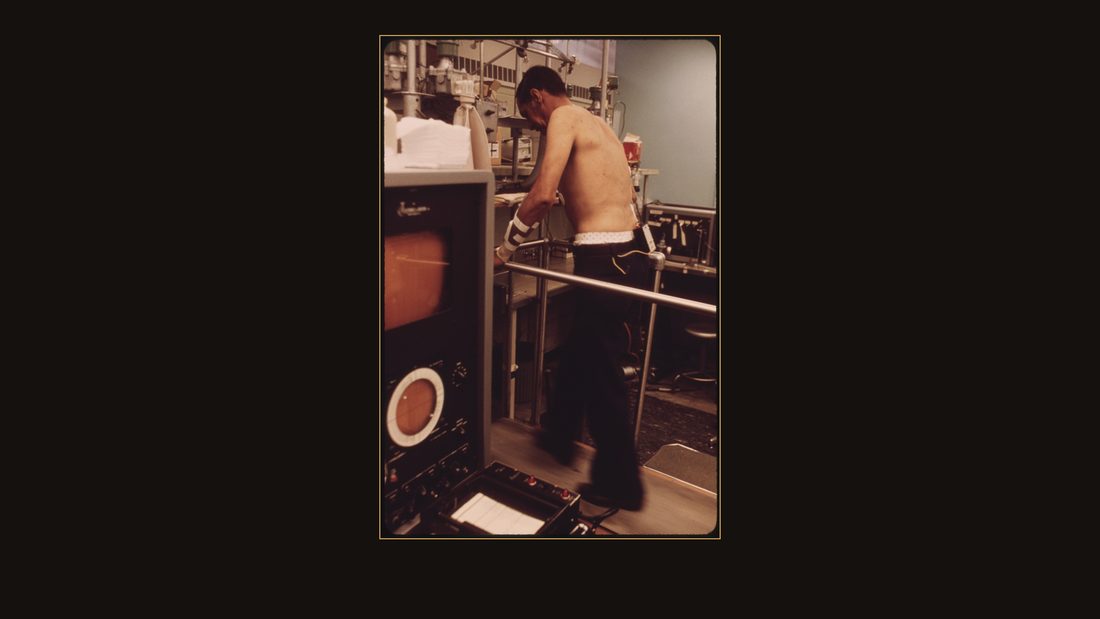 MINER WALKING ON A TREADMILL IN THE BLACK LUNG LABORATORY AT THE APPALACHIAN REGIONAL HOSPITAL IN BECKLEY, WEST VIRGINIA DURING THE TEST BLOOD SAMPLES WILL BE TAKEN FROM HIS WRIST,