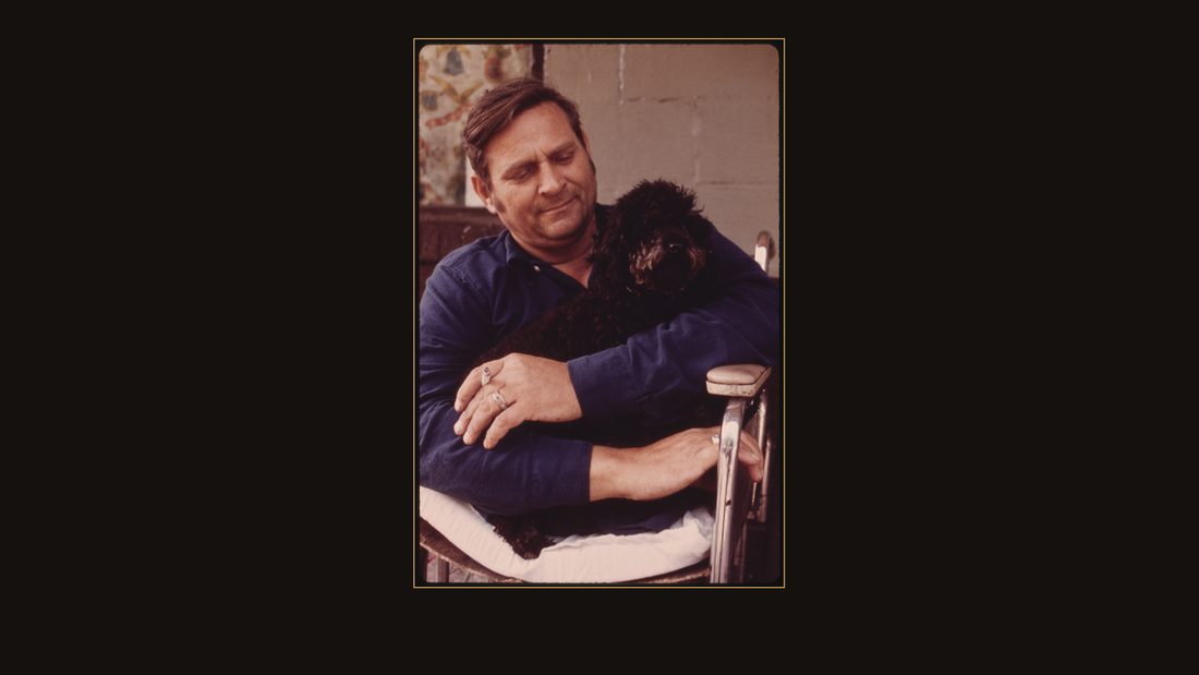 JACK SMITH, 42, A DISABLED MINER WHO LIVES IN RHODELL, WEST VIRGINIA, NEAR BECKLEY. HE HAD WORKED IN THE MINES ONE YEAR WHEN A ROCK CAVEIN CRUSHED HIS LEGS, AND IT TOOK HIM 18 YEAR
